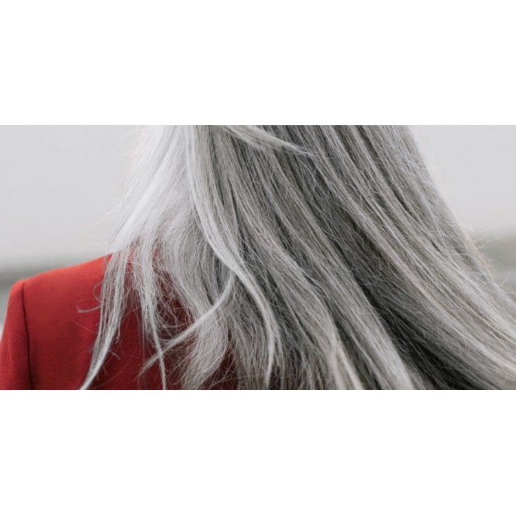 Розширені пори: проблема чи норма?