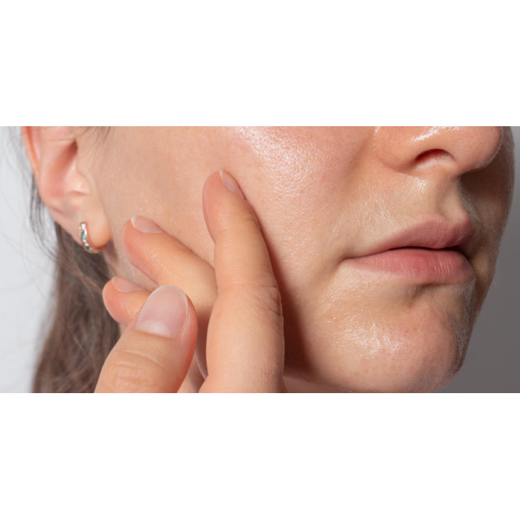 Розширені пори: проблема чи норма?