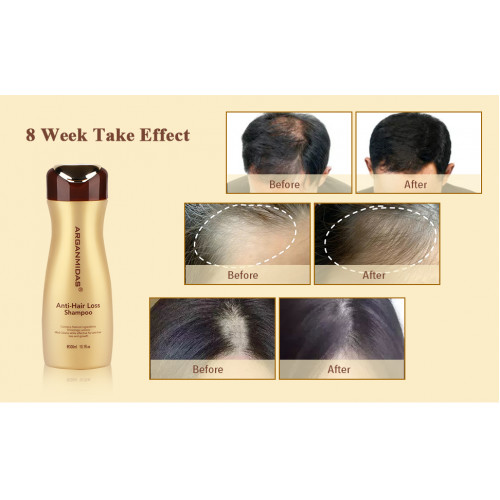 Arganmidas Anti-Hair Loss Shampoo 300ml Шампунь проти випадіння волосся