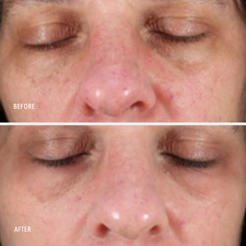 HydroPeptide Collagen Reactivate PM lifting Moisturizer+ Retinol 30ml Зволожуючий нічний ліфтинг крем з ретинолом