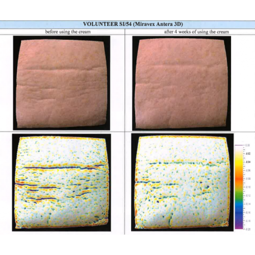 WhoCares Vegan PDRN Cream 50ml Зволожувальний крем для обличчя із веганськими полінуклеотидами