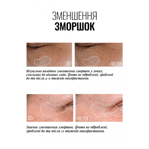 Instytutum Truly-Transforming Brightening Eye Cream 15ml Крем ліфтинг для повік з освітлювальним ефектом
