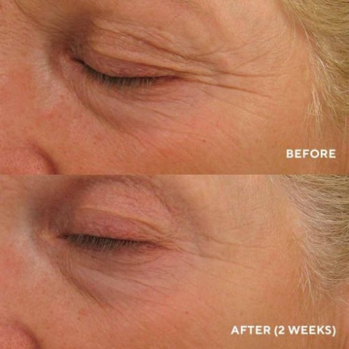 HydroPeptide Eye Authority 5ml МІНІАТЮРА Крем для комплексного омолодження зони навколо очей