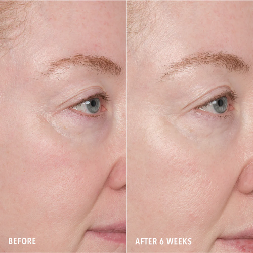 HydroPeptide Recurface and Repair Peptide Pads 1шт Пептидні пади для оновлення і регенерації шкіри